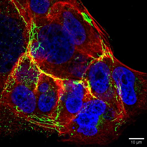 Huh-7 liver cancer cells stained for actin filaments